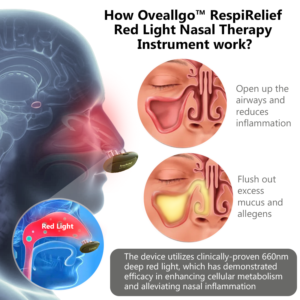 Oveallgo™ RespiRelief Red Light Nasal Therapy Instrument